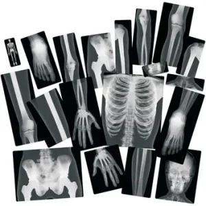 Set De 18 Laminas De Rayos X